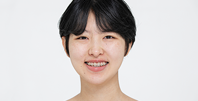 세라믹교정 장점 이미지