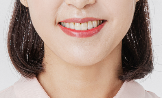 원데이 임플란트 치료과정 이미지
